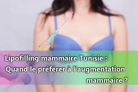 Lipofilling mammaire quand le préférer Medicalys