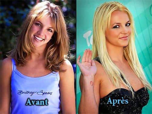 Britney Spears chirurgie mammaire avant apres