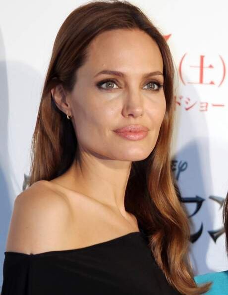 Angelina Jolie après la chirurgie esthétique