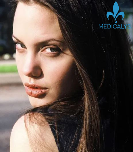 Angelina Jolie avant la chirurgie esthétique