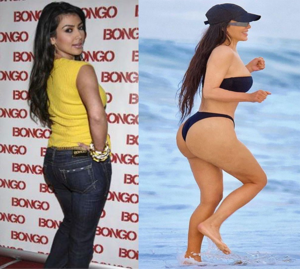 Kim Kardashian avant après son lipofilling des fesses