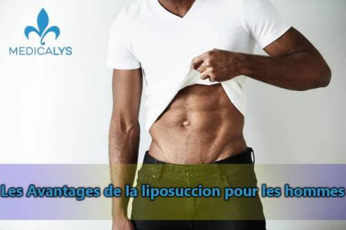 La liposuccion est-elle pertinente pour les hommes ?
