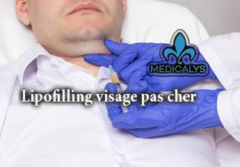 Pourquoi opter pour un lipofilling visage en Tunisie ?