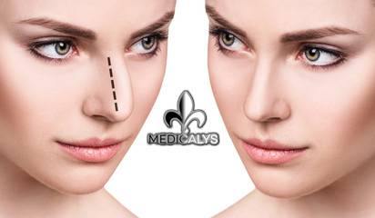 Rhinoplastie : l'opération qui vous convient ?